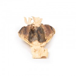 Abdominaal Aorta Aneurysma, 3D Print Abdominaal Aorta Aneurysma, 3D Print