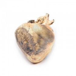 Atriumseptumdefect, 3D Print