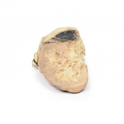 Bijnierbloeding - Syndroom van Waterhouse-Friderichsen, 3D Print