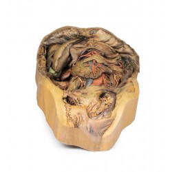 Buik met Liesbreuk, 3D Print