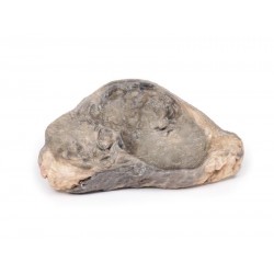 Carcinoom in de Borst, 3D Print