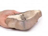Carcinoom in de Borst, 3D Print
