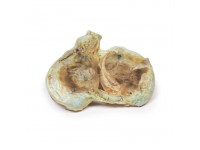 Chronische Hydrocele, 3D Print
