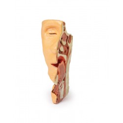 Dissectie Gezicht & Nek - Fossa Infratemporalis, 3D Print