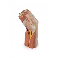 Fossa Cubitalis links, 3D Print Fossa Cubitalis links, 3D Print