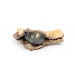 Galsteenileus, 3D Print