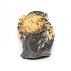 Gemetastaseerde Tumor in Long van eerdere teelbalkanker, 3D Print