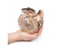 Gescheurd Thoracaal Aorta Aneurysma, 3D Print