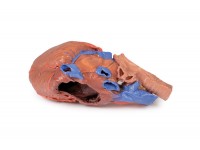 Hart en de distale trachea, carina en primaire bronchi, 3D Print