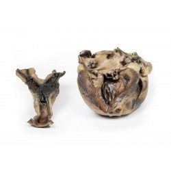 Hydatide Cysten, die het hart en de aorta aantasten, 3D Print