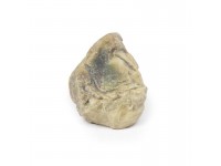 Hydrocele, 3D Print