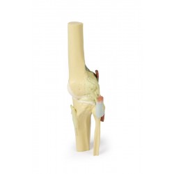 Knie, gestrekt, 3Dprint Knie, gestrekt, 3Dprint