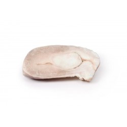 Leiomyoom in Baarmoeder, 3D Print