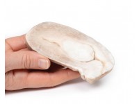 Leiomyoom in Baarmoeder, 3D Print