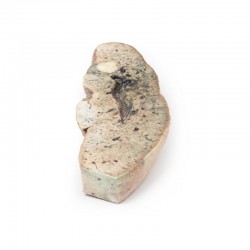 Levercirrose, 3D Print