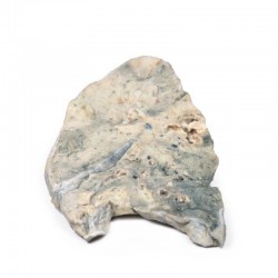 Long Staphylococcus Aureus Abces, 3D Print