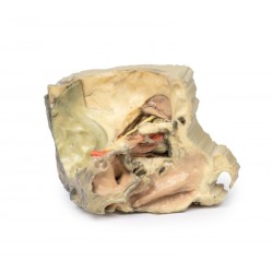 Mediale Oogkas, 3D Print