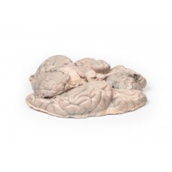 Meningeoom, 3D Print Meningeoom, 3D Print