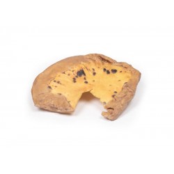 Mesenteriale Metastasen van Cutaan Maligne Melanoom, 3D Print