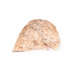 Miliaire Tuberculose Rechterlong, 3D Print Miliaire Tuberculose Rechterlong, 3D Print