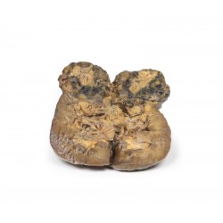 Niercelcarcinoom, 3D Print