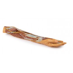 Onderarm & Hand - oppervlakkige en diepe dissectie, 3D Print Onderarm & Hand - oppervlakkige en diepe dissectie, 3D Print