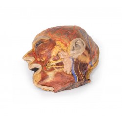 Oppervlakkige Gezichtszenuwen en Oorspeekselklier, 3D Print