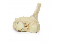 Osteosarcoom in Dijbeen, 3D Print