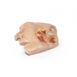 Parotisklier en Gezichtszenuw Dissectie, 3D Print