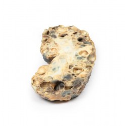 Polycystische Nierziekte, 3D Print