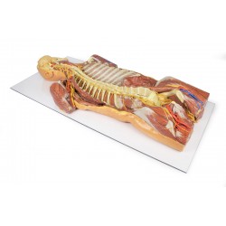 Posterieure Lichaamswand/Ventrale Diepe Dissectie, 3D Print