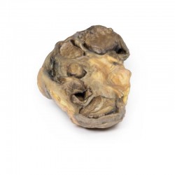 Pyonefrose, 3D Print