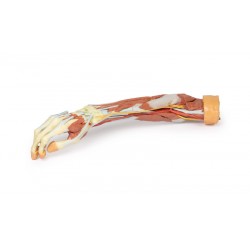 Rechter Arm, 3D Print Rechter Arm, 3D Print
