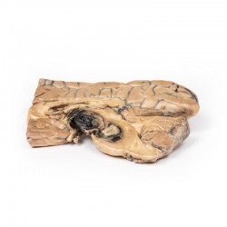 Sacculair Aneurysma van Basilaire Slagader, 3D Print