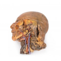 Sagittale Doorsnede Hoofd en Nek met Dissectie, 3D Print