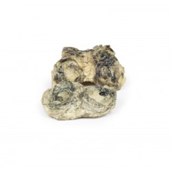 Suppuratieve Artritis in de Knie, 3D Print