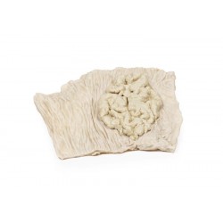 Villeus Adenoom in Dikke Darm, 3D Print