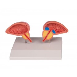 Prostaat Model, 2-delig