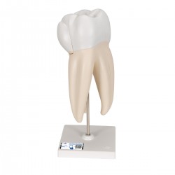 bovenste ware kies, 3 delig