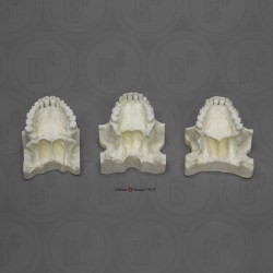 Maxilla Vergelijkingsset Maxilla Vergelijkingsset