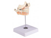 Melkgebit Model