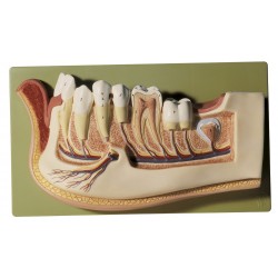 Model Onderkaak 12-jarig Kind 