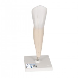 Onderste Hoektand (Dentes caninus) 2-delig