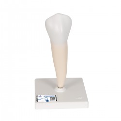 Onderste valse kies (Dentes premolares)