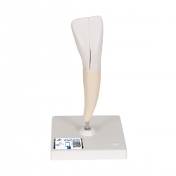 Snijtand onderkaak (Dentes incisivi)