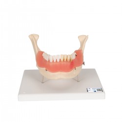 Ziektebeelden van het gebit, 2x vergroot, 21-delig