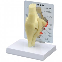 Basis Knie Model