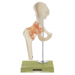 Functioneel Heupgewricht Model Somso