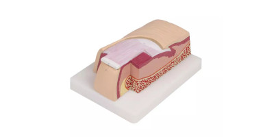 Vergroot Vingernagel model