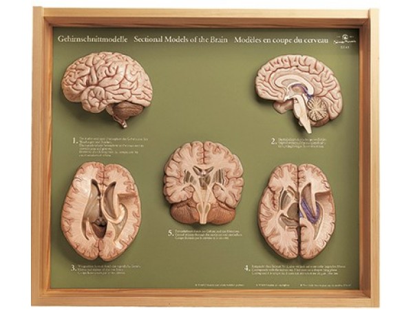 Doorsnede Hersenen Model, 5 Secties